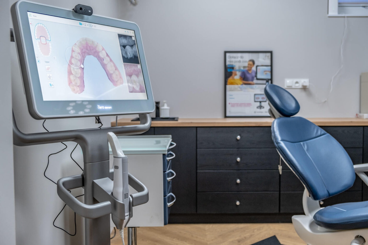 Ile kosztuje Invisalign? Ile kosztuje Invisalign?